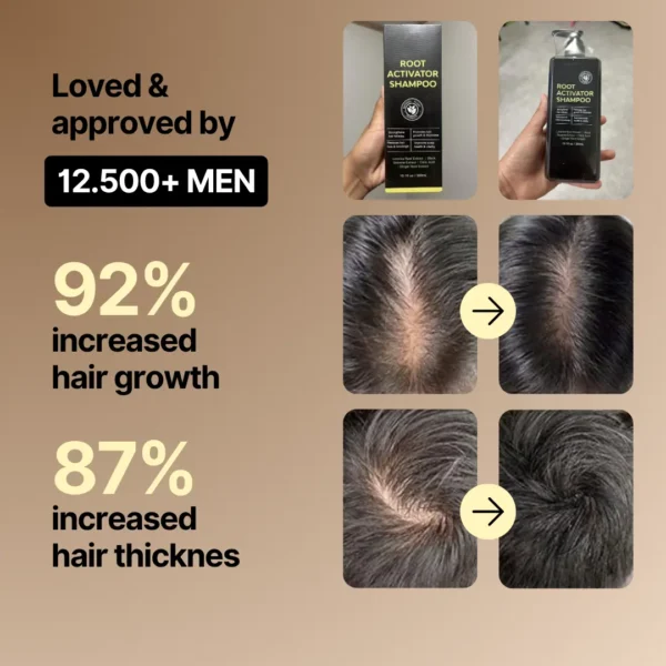 HairyPro® Root Activator Shampoo